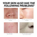 Hyaluronic Acid Liquid Foundation Waterproof No Creasing Long-Lasting Moisturizing No Separation Oil-Free Female Makeup Products